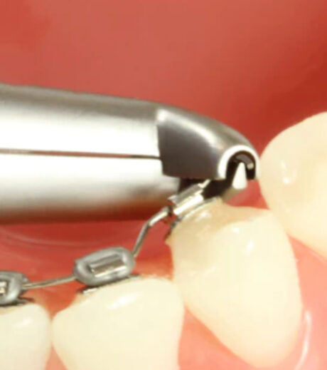 Dental Orthodontic Hammerhead Cinch Back Plier